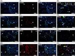 K-cadherin Antibody in Immunohistochemistry (IHC)