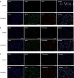 Fibronectin Antibody in Immunocytochemistry (ICC/IF)