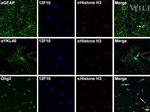 CHI3L1 Antibody in Immunohistochemistry (IHC)