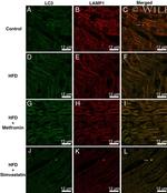 LAMP1 Antibody in Immunohistochemistry (IHC)