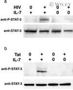 STAT3 Antibody in Western Blot (WB)