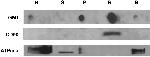 ATP1A1 Antibody in Western Blot (WB)