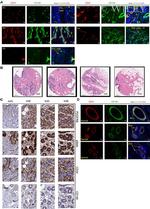 CD34 Antibody in Immunohistochemistry (IHC)