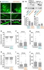 GSK3 alpha/beta Antibody in Western Blot (WB)