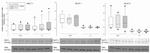 Villin Antibody in Western Blot (WB)