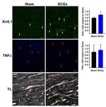 Kir6.1 (KCNJ8) Antibody in Immunohistochemistry (IHC)