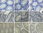 Bcl-2 Antibody in Immunohistochemistry (IHC)