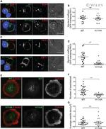 CD3 Antibody in T-Cell Activation (TCA)