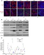 SLC34A3 Antibody in Western Blot, Immunocytochemistry (WB, ICC/IF)