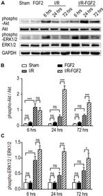 ERK1/ERK2 Antibody in Western Blot (WB)