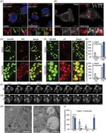 LAMP1 Antibody in Immunocytochemistry (ICC/IF)