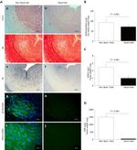 Actin Antibody in Immunohistochemistry (IHC)