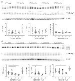 LC3B Antibody in Western Blot (WB)