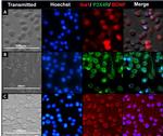 BDNF Antibody in Immunocytochemistry (ICC/IF)