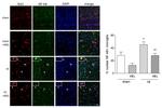 IBA1 Antibody in Immunohistochemistry (IHC)