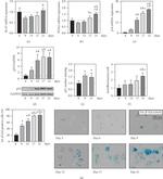 p21 Antibody in Immunocytochemistry (ICC/IF)