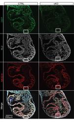 O-linked N-acetylglucosamine (O-GlcNAc) Antibody in Immunohistochemistry (IHC)