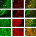 Calsequestrin Antibody in Immunohistochemistry (Paraffin) (IHC (P))