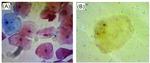 Cytokeratin 5 Antibody in Immunocytochemistry, Immunohistochemistry (ICC/IF, IHC)