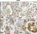 ACSL3 Antibody in Immunohistochemistry (IHC)