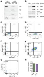 Progesterone Receptor Antibody in Western Blot (WB)