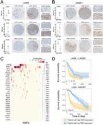 HENMT1 Antibody in Immunohistochemistry (IHC)