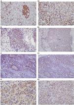 CX3CR1 Antibody in Immunohistochemistry (IHC)