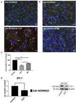 Claudin 5 Antibody in Immunocytochemistry (ICC/IF)