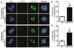 gamma Tubulin Antibody in Immunocytochemistry (ICC/IF)