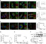 Alix Antibody in Immunocytochemistry (ICC/IF)