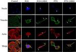 Vinculin Antibody in Immunocytochemistry (ICC/IF)