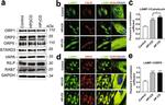 ORP5 Antibody in Immunocytochemistry (ICC/IF)