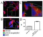 Borrelia burgdorferi Antibody in Immunocytochemistry (ICC/IF)