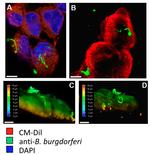 Borrelia burgdorferi Antibody in Immunocytochemistry (ICC/IF)