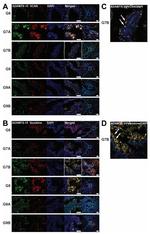 Versican V0, V1 Neo Antibody in Immunocytochemistry (ICC/IF)