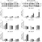 beta Amyloid Antibody in Western Blot (WB)