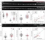 Calsequestrin Antibody in Western Blot (WB)