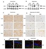 IBA1 Antibody in Immunohistochemistry (IHC)