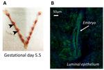 Annexin A1 Antibody in Immunocytochemistry (ICC/IF)