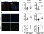 PAX6 Antibody in Immunohistochemistry (IHC)