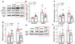 TXNIP Antibody in Western Blot (WB)