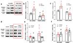 TXNIP Antibody in Western Blot (WB)