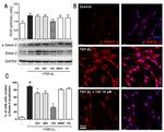 SMAD2 Antibody in Western Blot (WB)