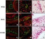 BAI1 Antibody in Immunohistochemistry (IHC)