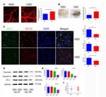 CD31 Antibody in Immunohistochemistry (IHC)