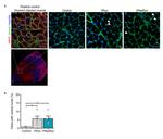 Laminin Antibody in Immunohistochemistry (IHC)