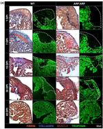 Cardiac Troponin T Antibody in Immunohistochemistry (IHC)