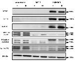 PARP1 Antibody in Western Blot (WB)