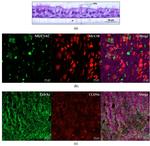 MUC5AC Antibody in Immunohistochemistry (IHC)