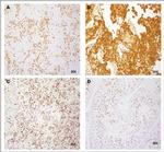 ZCCHC8 Antibody in Immunohistochemistry (IHC)